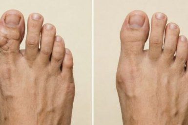 Скажите "нет" косточкам на больших пальцах: 3 беспроигрышные практики, которые стоит попробовать