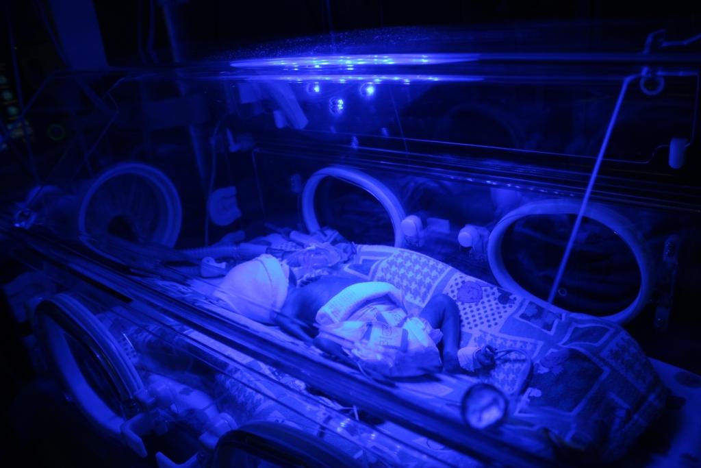 В Якутии все чаще рождаются недоношенные дети